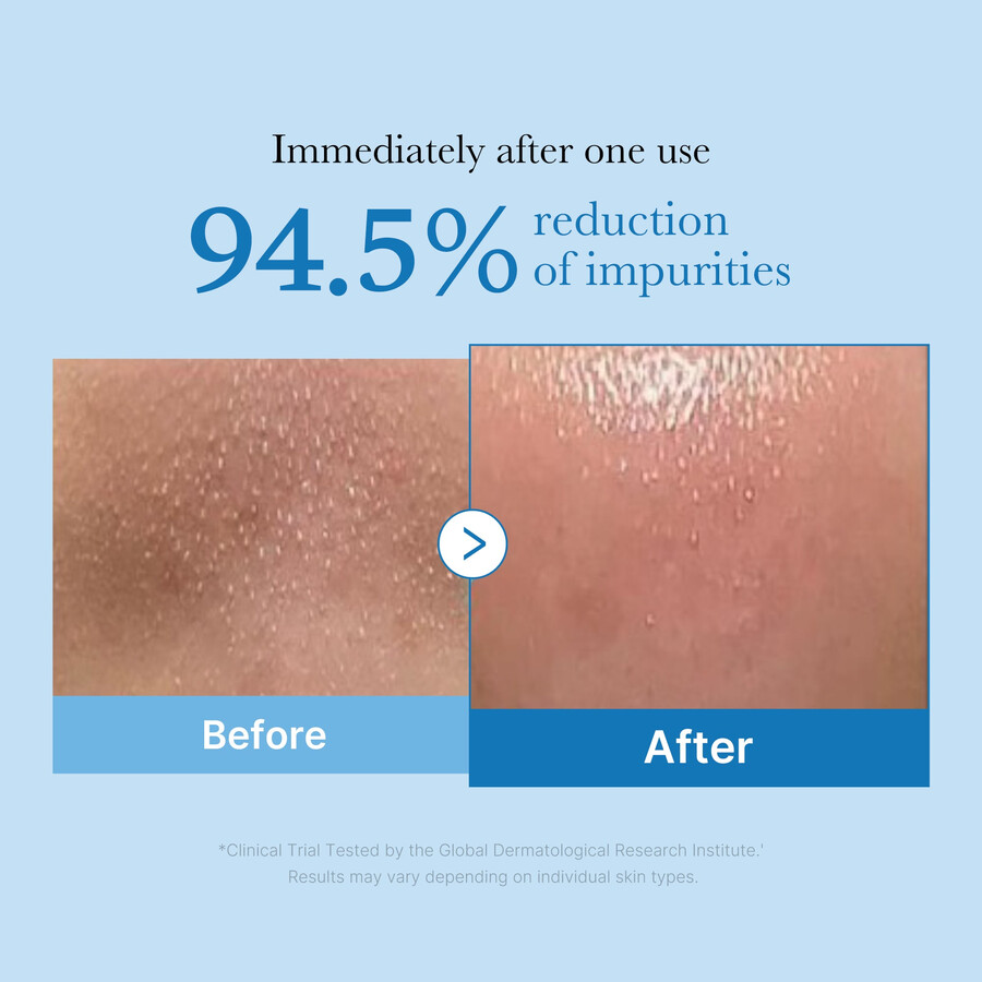 aceite de limpieza profunda para puntos negros medicube zero pore