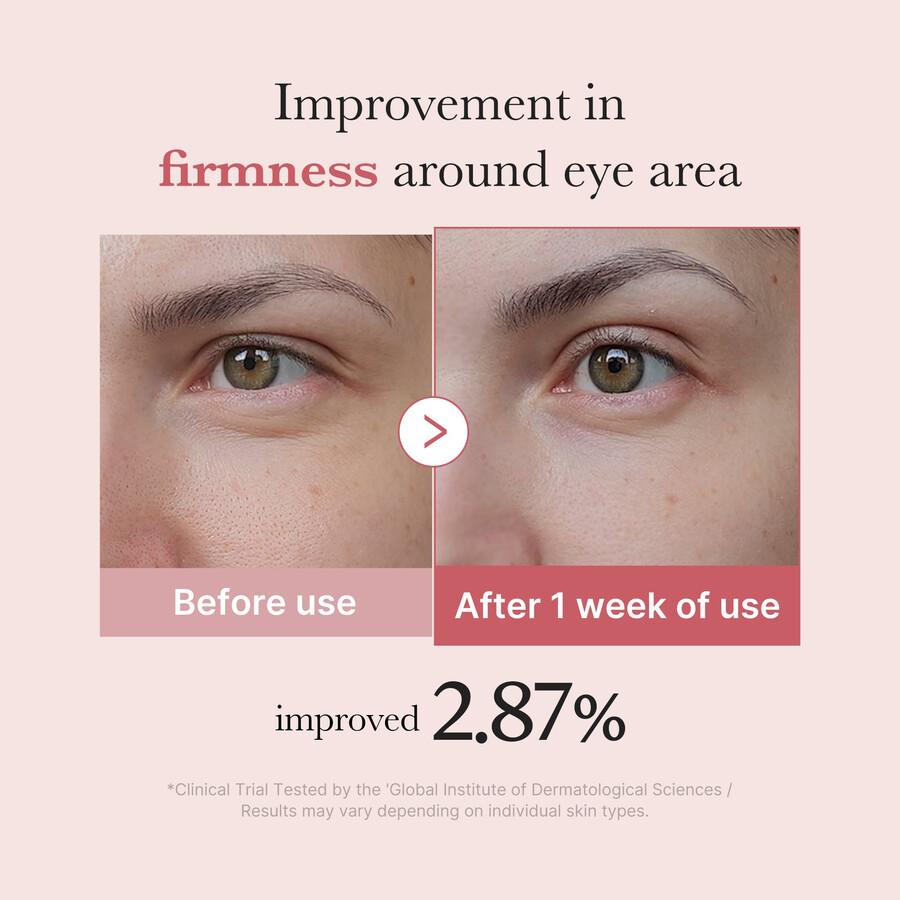 crema para ojos con péptidos rosados pdrn de medicube